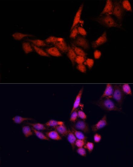 Immunohistochemistry - SIRT1 Polyclonal Antibody (144-011267)