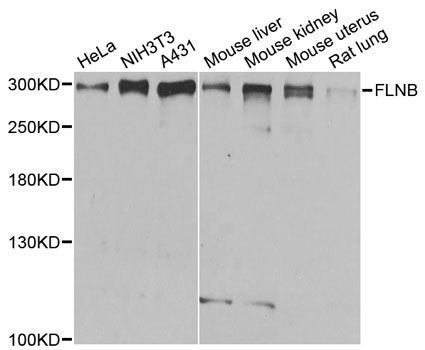 Western blot - FLNB Polyclonal Antibody (144-02481)