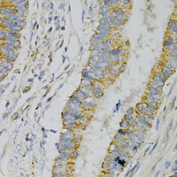 Immunohistochemistry - GNAO1 Antibody (144-02510)