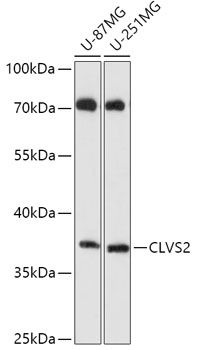 Western blot