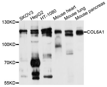 Western blot - COL6A1 antibody (144-09236)