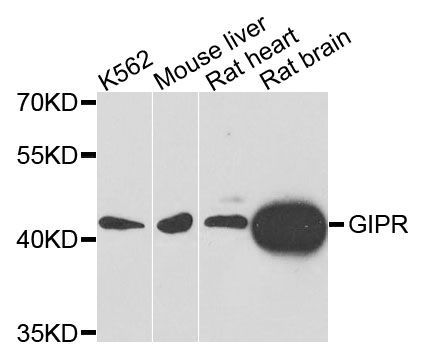 Western blot - GIPR antibody (144-09816)