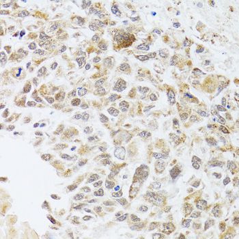 Immunohistochemistry - RNASEL antibody (144-09840)