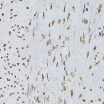 Immunohistochemistry - HNRNPD Polyclonal Antibody (144-01828)