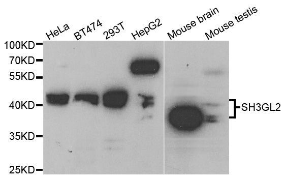 Western blot - SH3GL2 Polyclonal Antibody (144-05701)