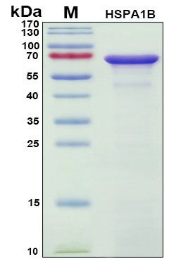 SDS-PAGE