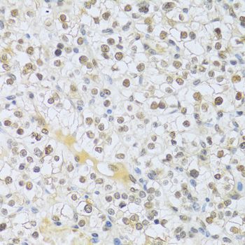 Immunohistochemistry - MAPK3 Polyclonal Antibody (144-00228)