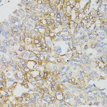 Immunohistochemistry - ND5 antibody (144-08135)