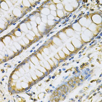 Immunohistochemistry - PDGFB Polyclonal Antibody (144-01195)