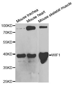 Western blot - WIF1 Polyclonal Antibody (144-05386)