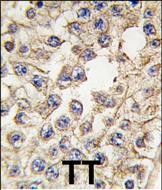 IHC-P