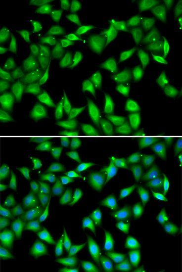 Immunofluorescence - MYL3 antibody (144-06662)
