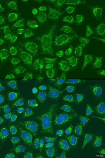 Immunofluorescence - FCGR3B antibody (144-60537)