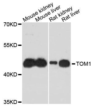 Western blot - TOM1 Polyclonal Antibody (144-61471)
