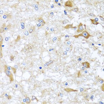 Immunohistochemistry - ABCB8 antibody (144-02653)