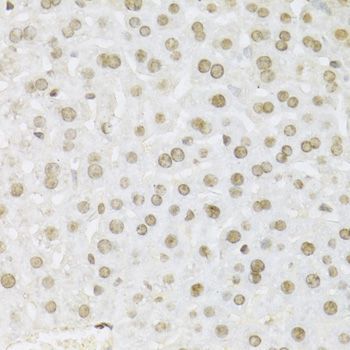 Immunohistochemistry - MAPK3 Polyclonal Antibody (144-00228)