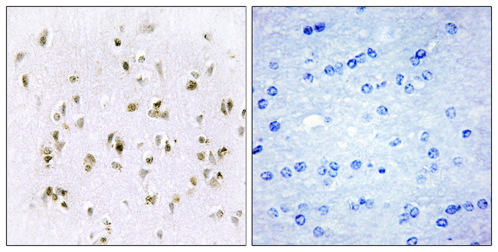 IHC