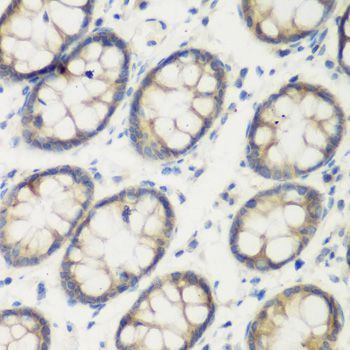 Immunohistochemistry - TGM5 antibody (144-07039)