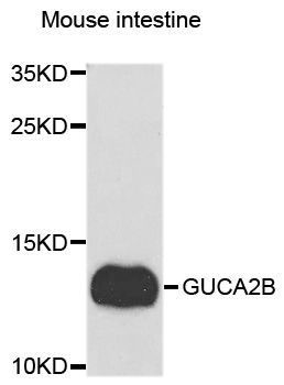 Western blot - GUCA2B antibody (144-08390)