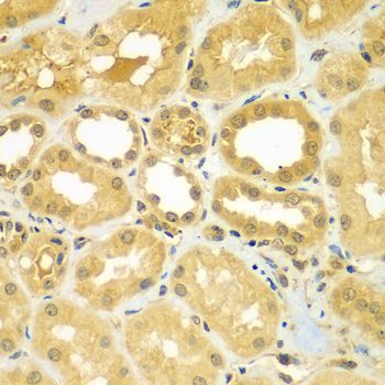 Immunohistochemistry - CALCOCO1 antibody (144-07987)