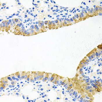 Immunohistochemistry - TOB2 antibody (144-07223)