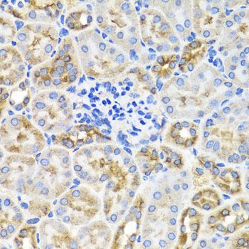 Immunohistochemistry - PRKAG1 antibody (144-07300)