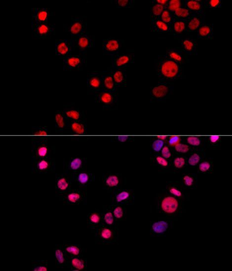 Immunofluorescence - XRCC6 Polyclonal Antibody (144-00883)