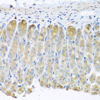 Immunohistochemistry - TAMM41 antibody (144-08374)
