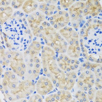 Immunohistochemistry - SULT1A1 antibody (144-01599)