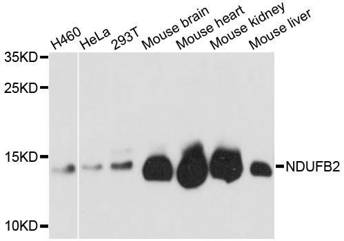 Western blot - NDUFB2 antibody (144-61375)