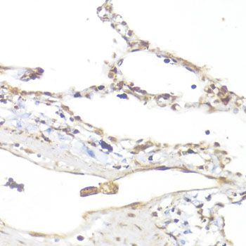Immunohistochemistry - Smad5 antibody (144-01947)