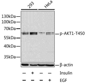 Western blot