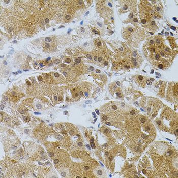 Immunohistochemistry - TGM2 Polyclonal Antibody (144-00981)