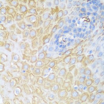 Immunohistochemistry - CDK1 antibody (144-012414)