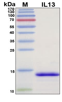 SDS-PAGE Image