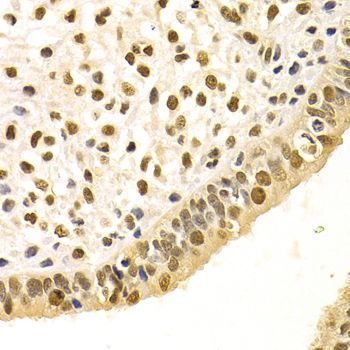 Immunohistochemistry - DDB1 Polyclonal Antibody (144-02896)