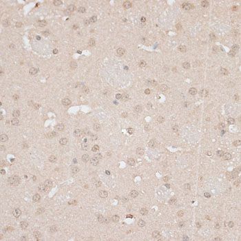 Immunohistochemistry - GPKOW antibody (144-013214)