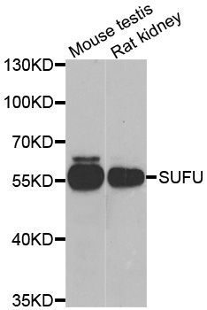 Western blot - SUFU Polyclonal Antibody (144-06757)