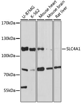 Western blot