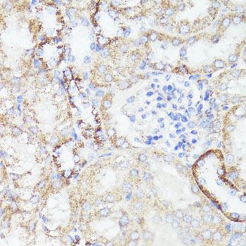 Immunohistochemistry - [KO Validated] ErbB2 Polyclonal Antibody (144-02071)