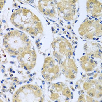 Immunohistochemistry - FBXL5 antibody (144-05602)