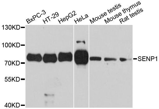 Western blot - SENP1 antibody (144-60180)