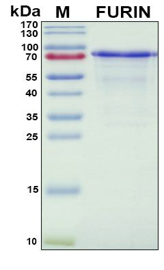SDS-PAGE