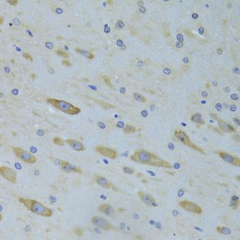 Immunohistochemistry - SARS Polyclonal Antibody (144-06733)