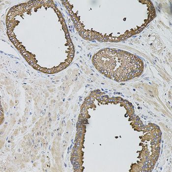 Immunohistochemistry - CASP12 Polyclonal Antibody (144-00217)