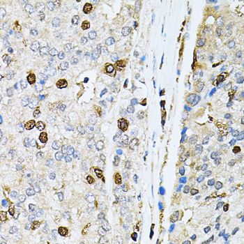 Immunohistochemistry - PNKP antibody (144-06693)
