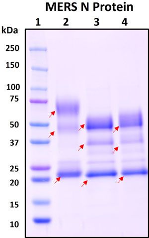SDS-PAGE