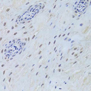 Western blot - TARDBP Polyclonal Antibody (144-01183)