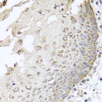 Immunohistochemistry - IRS2 antibody (144-07945)
