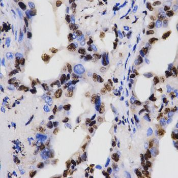 Immunohistochemistry - DiMethyl-Histone H3-K4 pAb (144-61340)